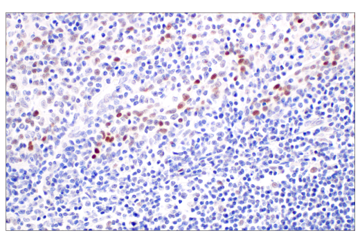 Immunohistochemistry Image 6: p53 (DO-1) Mouse Monoclonal Antibody