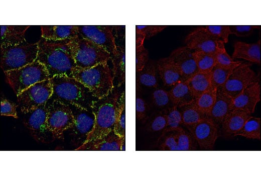 Immunofluorescence Image 1: alpha-E-Catenin Antibody