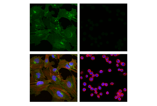 Immunofluorescence Image 1: CD248 (E9Z7O) Rabbit Monoclonal Antibody (BSA and Azide Free)