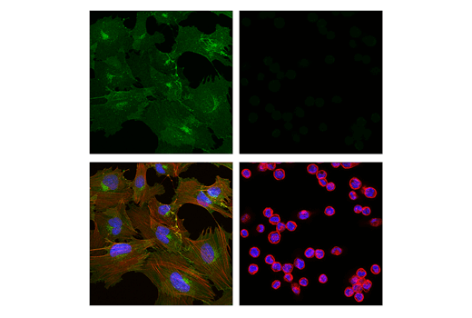 Immunofluorescence Image 1: CD248 (E9Z7O) XP<sup>®</sup> Rabbit mAb (BSA and Azide Free)