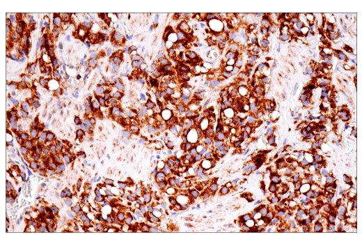 Immunohistochemistry Image 2: SDHB (E3H9Z) Rabbit Monoclonal Antibody