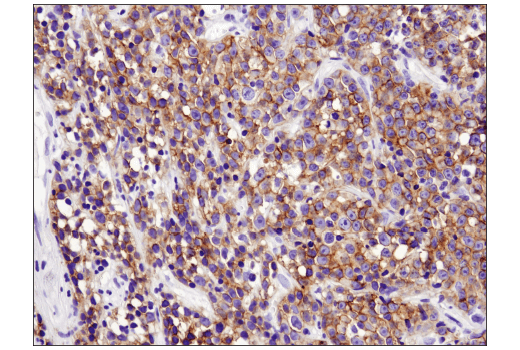 Immunohistochemistry Image 1: CXCR5 (D6L3C) Rabbit Monoclonal Antibody (BSA and Azide Free)