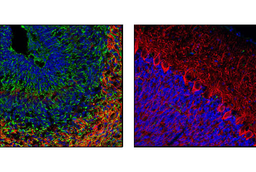Immunofluorescence Image 1: Nestin (Rat-401) Mouse Monoclonal Antibody (BSA and Azide Free)