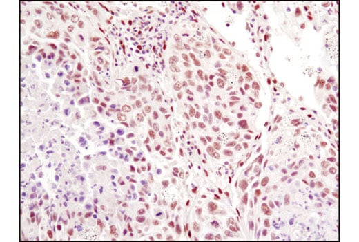 undefined Image 19: Huntingtin Interaction Antibody Sampler Kit