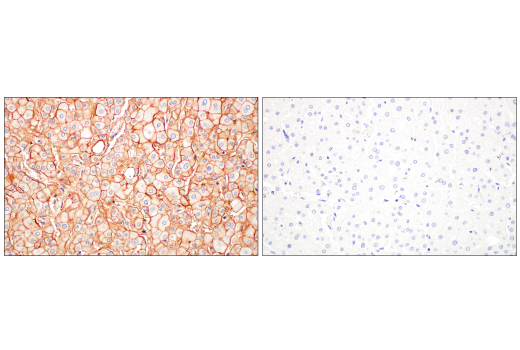Immunohistochemistry Image 12: JAM-A (E8D2N) Rabbit Monoclonal Antibody