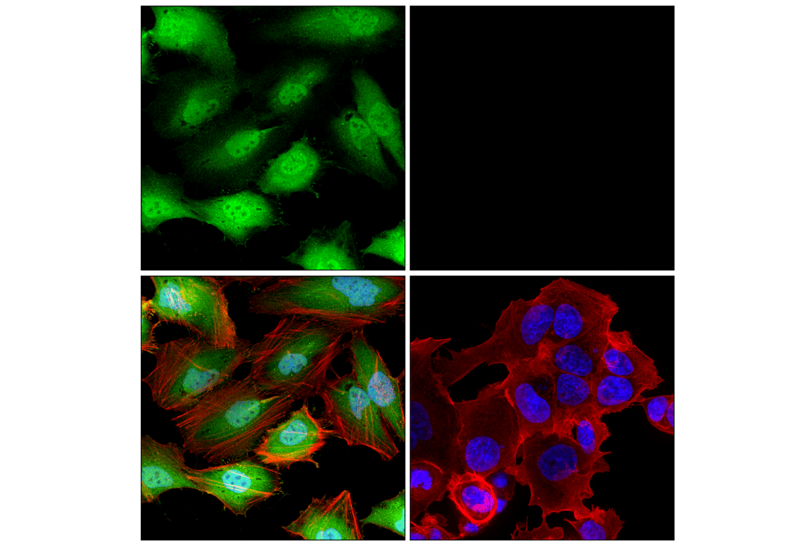 Immunofluorescence Image 1: p16 INK4A (BC42) Mouse Monoclonal Antibody