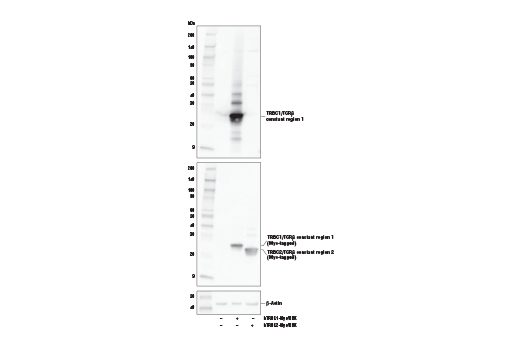 Western Blotting Image 2: TRBC1/TCR beta constant region 1 Antibody