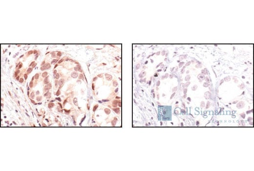Phospho-Akt (Thr308) (C31E5E) Rabbit mAb | Cell Signaling