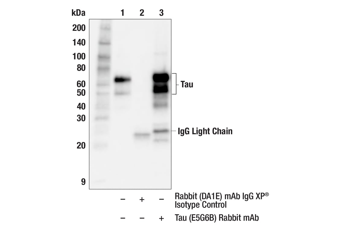 Immunoprecipitation Image 1: Tau (E5G6B) Rabbit Monoclonal Antibody