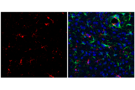 Immunofluorescence Image 2: CD68 (E3O7V) Rabbit Monoclonal Antibody