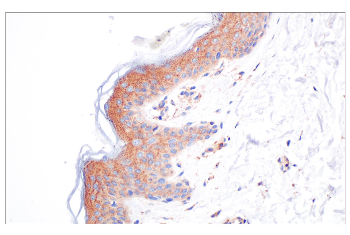 Immunohistochemistry Image 8: EEA1 (E9Q6G) Mouse Monoclonal Antibody