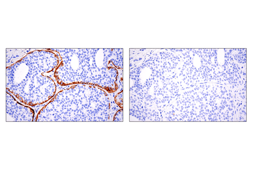 Immunohistochemistry Image 1: CD10/Neprilysin (E5P7S) Rabbit Monoclonal Antibody