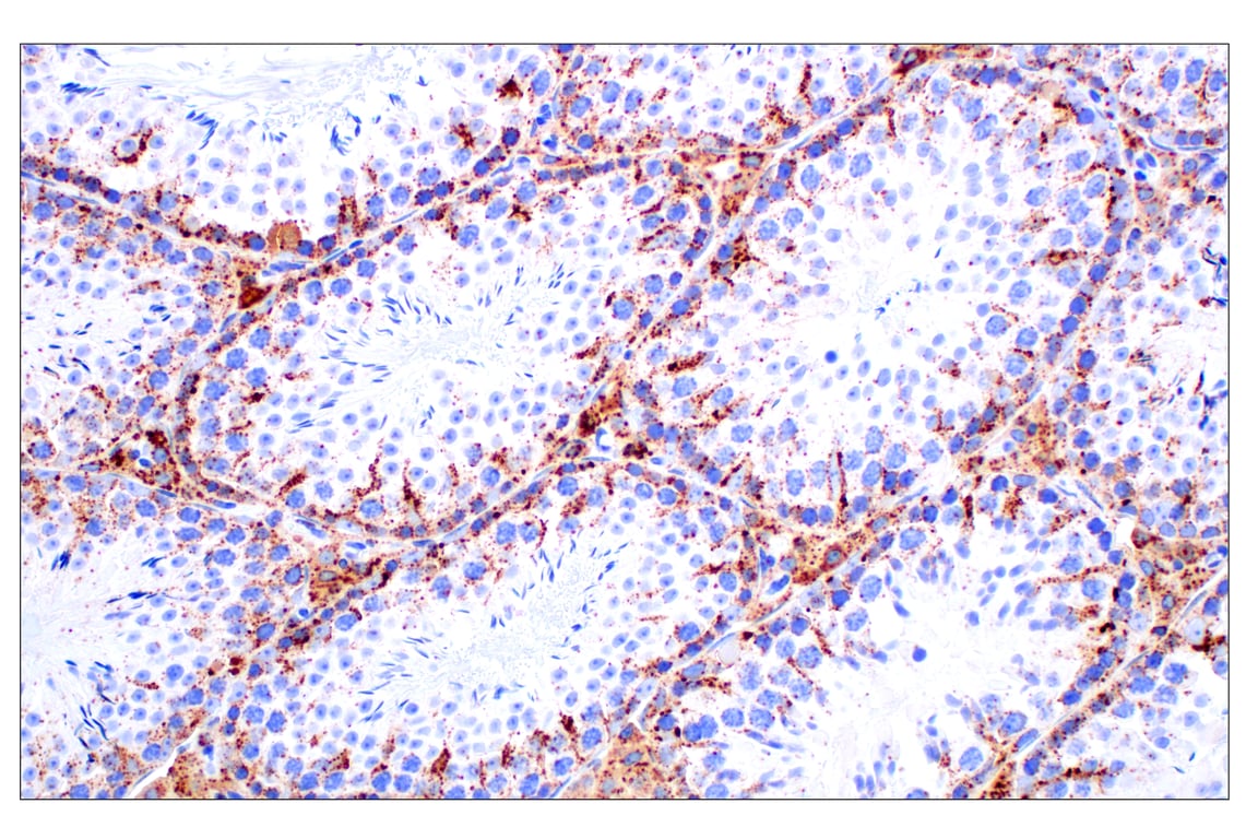 undefined Image 42: Genetics of Parkinson's Disease: Lysosomal Dysfunction Antibody Sampler Kit