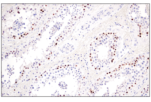 Immunohistochemistry Image 4: PRAME (E7I1B) Rabbit Monoclonal Antibody