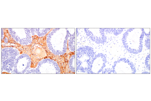Immunohistochemistry Image 3: COL3A1 (E8D7R) Rabbit Monoclonal Antibody (BSA and Azide Free)