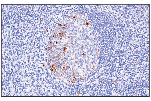 Immunohistochemistry Image 3: RHAMM/CD168 (E7S4Y) Rabbit Monoclonal Antibody (BSA and Azide Free)