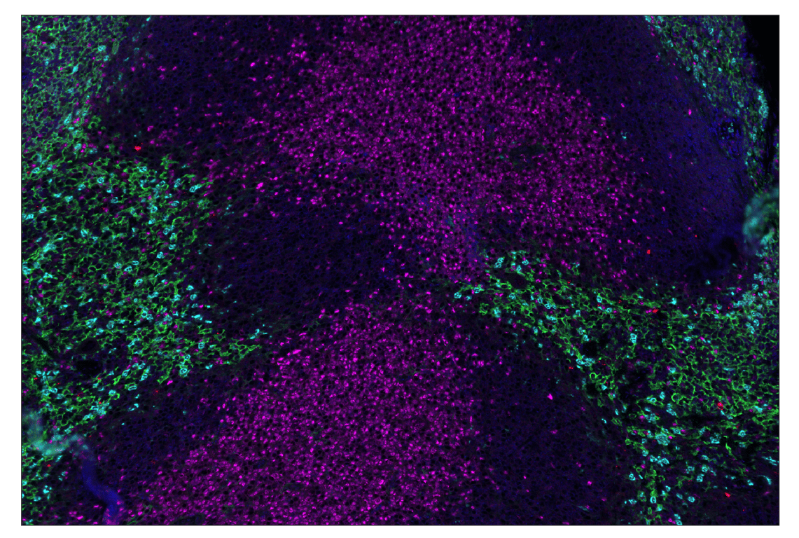 Immunohistochemistry Image 1: Granzyme B (E5V2L) & CO-0049-594 SignalStar<sup>™</sup> Oligo-Antibody Pair