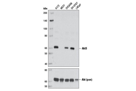 Western Blotting Image 1: Akt3 (L47B1) Mouse mAb