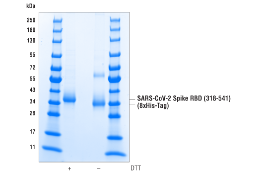 undefined Image 3: SARS-CoV-2 Spike RBD (318-541) Recombinant Protein (8xHis-Tag)