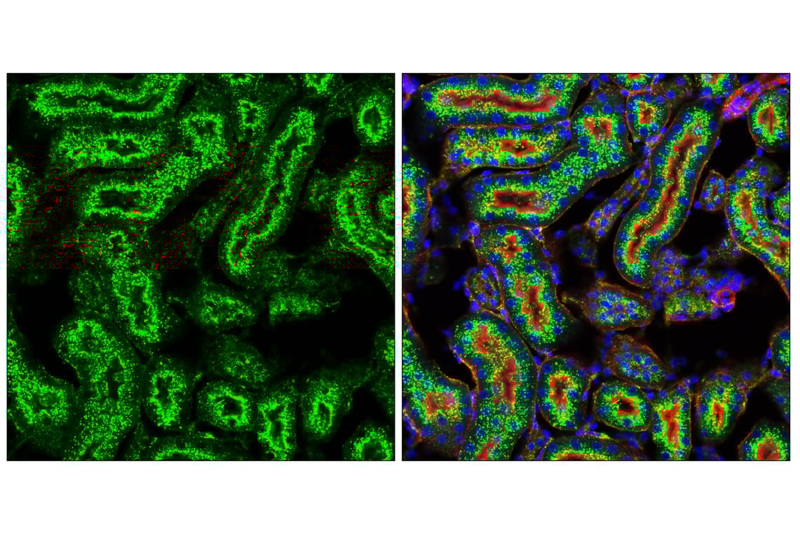 Immunofluorescence Image 2: LAMP2 (E6A6S) Rabbit Monoclonal Antibody