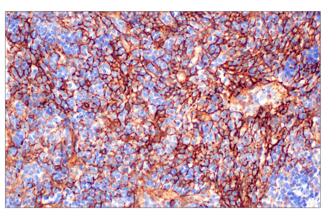 Immunohistochemistry Image 7: NT5E/CD73 (D7F9A) Rabbit Monoclonal Antibody