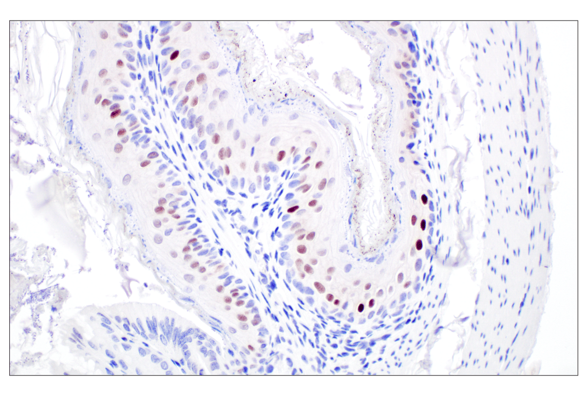 p21 Waf1/Cip1 (F7S9M) Rabbit Monoclonal Antibody | Cell Signaling