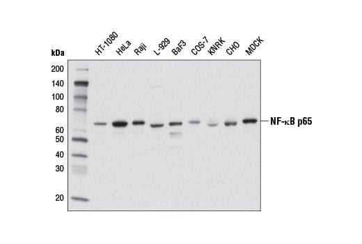 undefined Image 10: NF-kappaB p65 Antibody Sampler Kit