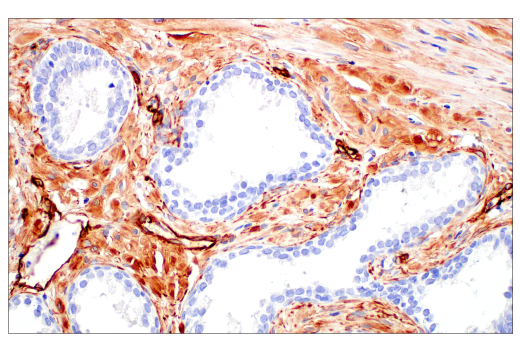 Immunohistochemistry Image 9: Nestin (E4O9E) Rabbit Monoclonal Antibody (BSA and Azide Free)