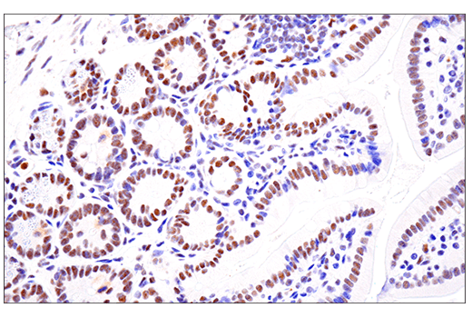 Immunohistochemistry Image 10: SETD2 (E4W8Q) Rabbit Monoclonal Antibody (IHC Formulated)