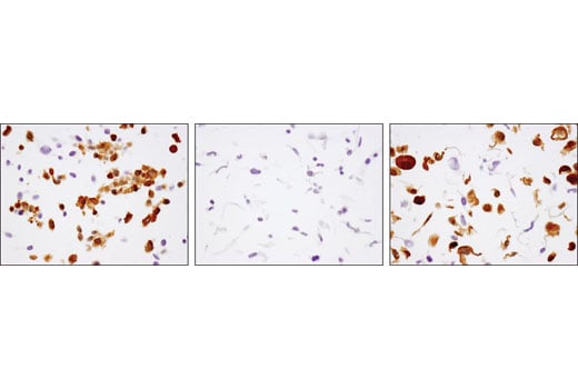 Immunohistochemistry Image 2: MEK1 (D2R1O) Rabbit Monoclonal Antibody