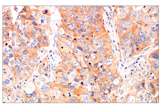 Immunohistochemistry Image 5: Ras (E8N8L) Rabbit Monoclonal Antibody (BSA and Azide Free)