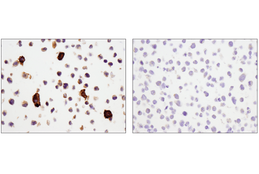 Immunohistochemistry Image 5: CD14 (D7A2T) Rabbit Monoclonal Antibody (IHC Formulated)