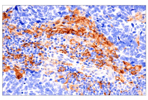 Immunohistochemistry Image 1: FcRn (E9J8W) Rabbit Monoclonal Antibody (BSA and Azide Free)