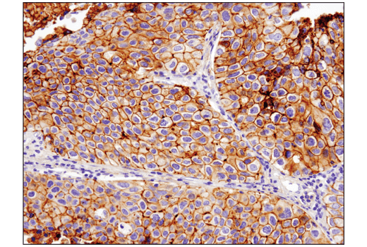 Immunohistochemistry Image 1: B7-H3 (D9M2L) Rabbit Monoclonal Antibody (BSA and Azide Free)
