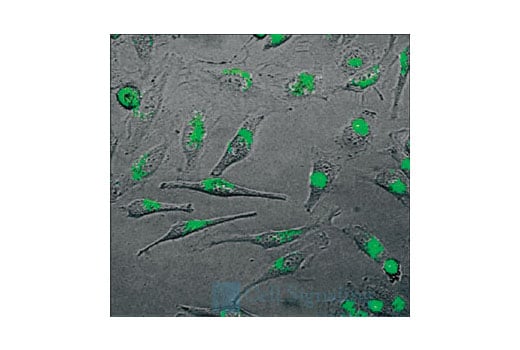 undefined Image 1: SignalSilence<sup>®</sup> HSP27 siRNA I