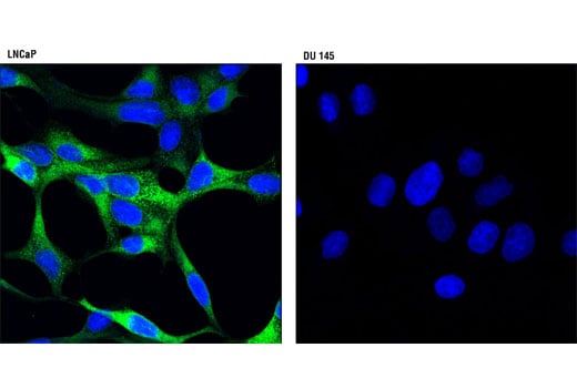 Immunofluorescence Image 1: PSA/KLK3 (D2A8) Rabbit Monoclonal Antibody