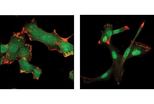 Immunofluorescence Image 1: SMAD3 (C67H9) Rabbit Monoclonal Antibody (BSA and Azide Free)