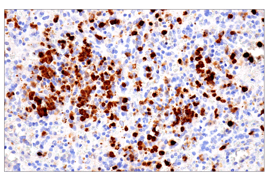 Immunohistochemistry Image 7: S100A8 (F4R2W) Rabbit Monoclonal Antibody (BSA and Azide Free)