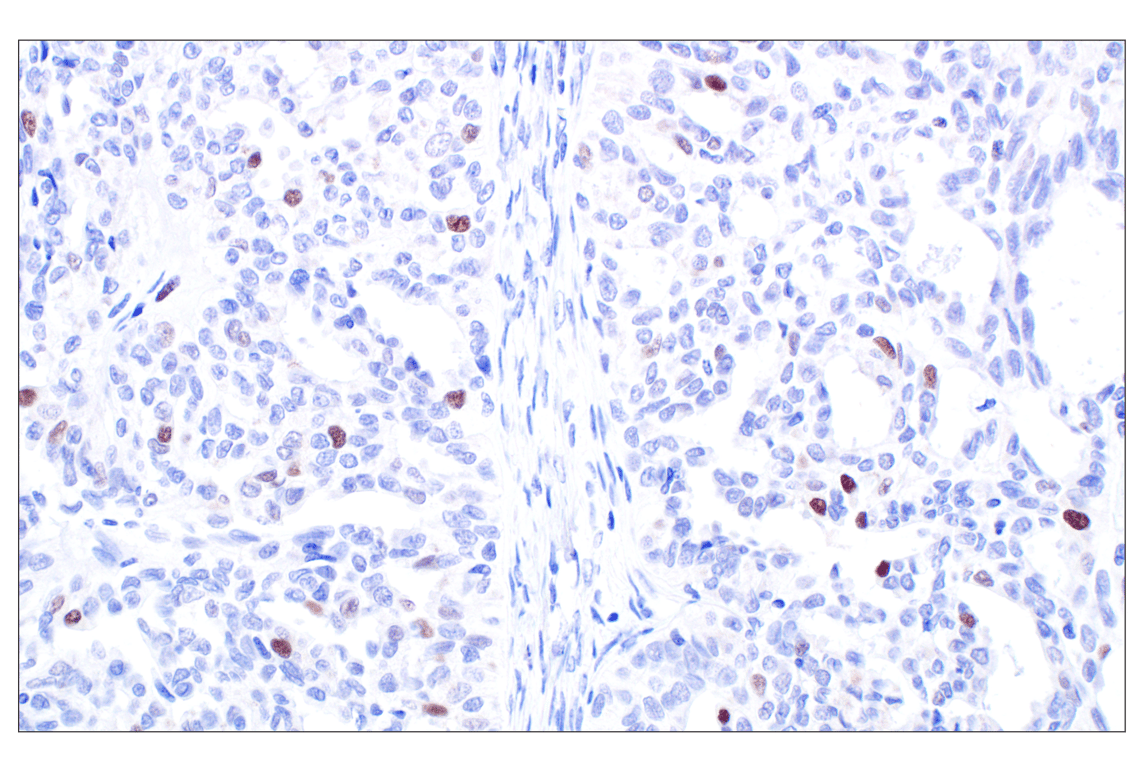 Immunohistochemistry Image 3: MASTL (F7I2C) Rabbit Monoclonal Antibody