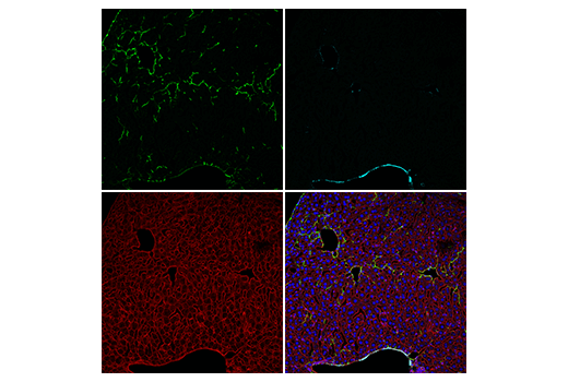 COL1A1 (E8F4L) XP® Rabbit mAb (Alexa Fluor® 488 Conjugate