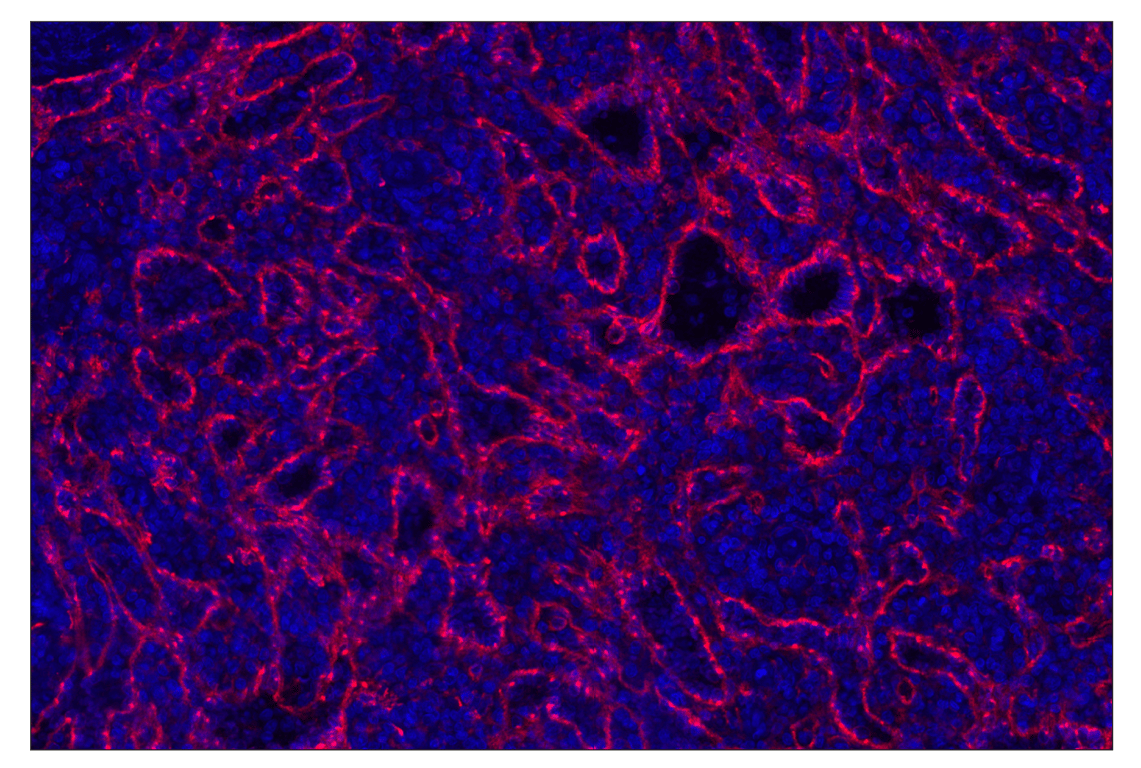 Immunohistochemistry Image 2: CD206/MRC1 (E2L9N) Rabbit Monoclonal Antibody (Alexa Fluor<sup>®</sup> 647 Conjugate)