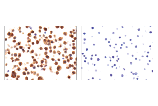 undefined Image 25: Human Reactive Inflammasome Antibody Sampler Kit II