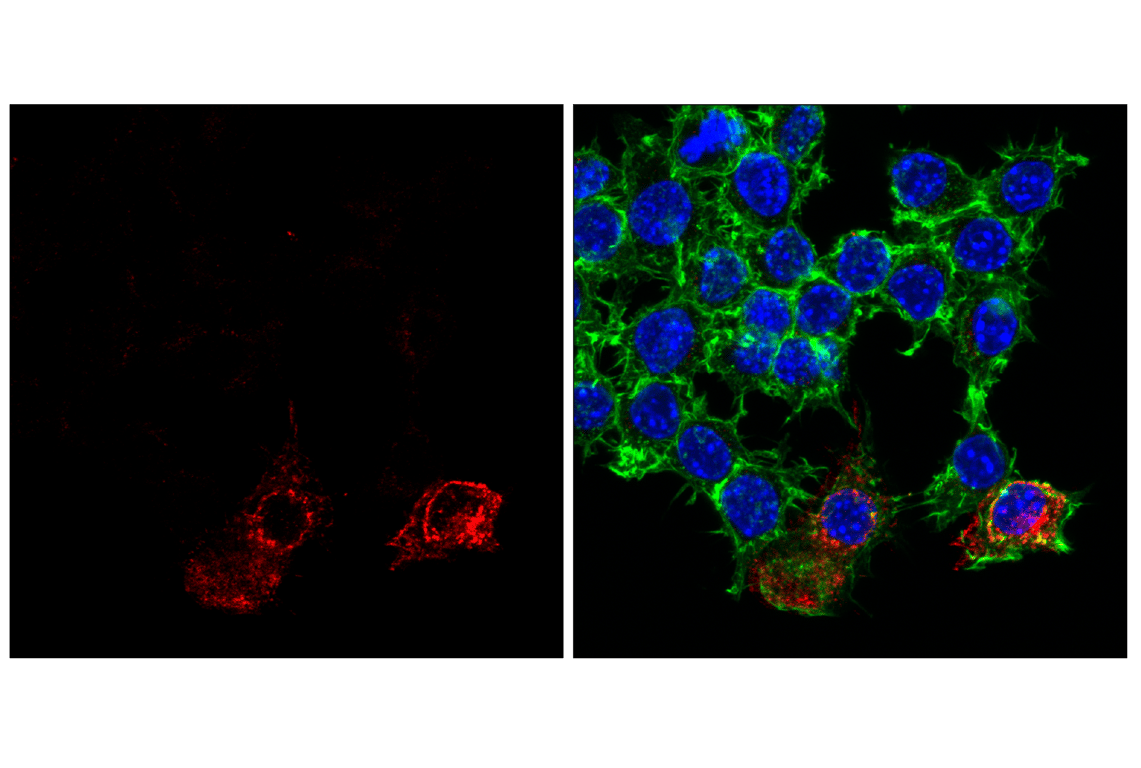 Immunofluorescence Image 4: CD11c (D1V9Y) Rabbit Monoclonal Antibody (Alexa Fluor<sup>®</sup> 647 Conjugate)