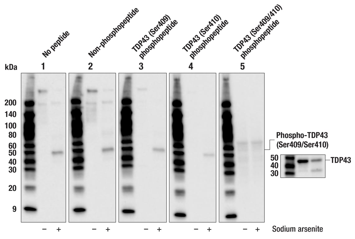 Western Blotting Image 2: Phospho-TDP43 (Ser409/Ser410) (F9S3F) Rabbit Monoclonal Antibody