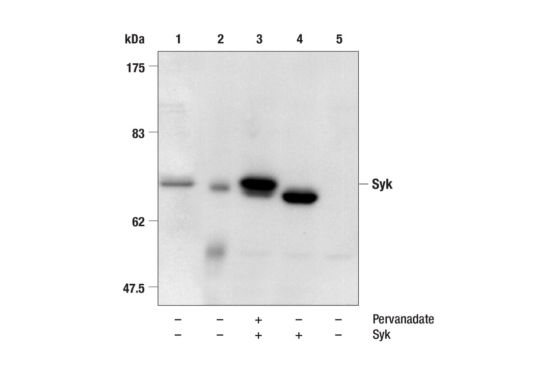 Western Blotting Image 1: Syk Antibody