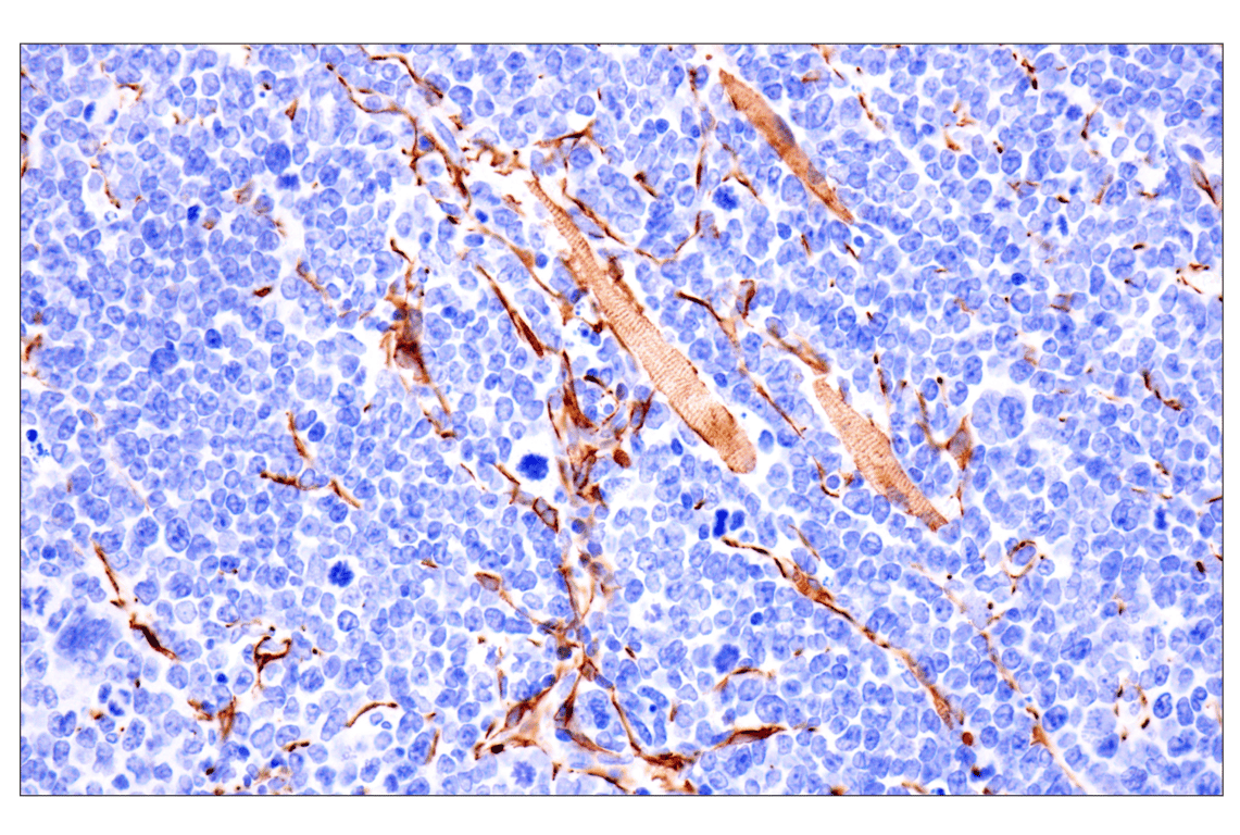 Immunohistochemistry Image 13: Desmin (F5V4I) Rabbit Monoclonal Antibody
