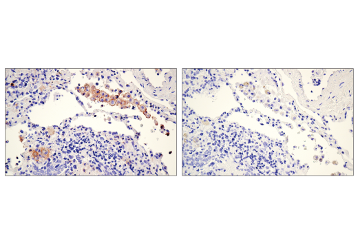 Immunohistochemistry Image 3: CD86 (E2G8P) Rabbit Monoclonal Antibody (BSA and Azide Free)