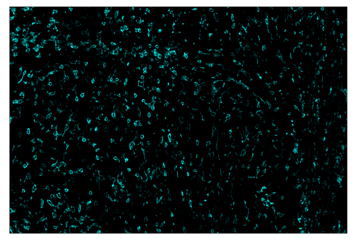 Immunohistochemistry Image 5: CD45 (D3F8Q) & CO-0046-750 SignalStar<sup>™</sup> Oligo-Antibody Pair