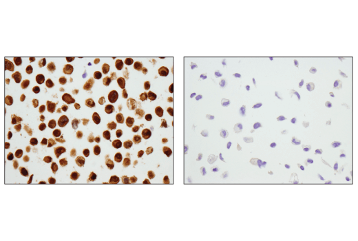 Immunohistochemistry Image 4: Stat3 (D1B2J) Rabbit Monoclonal Antibody (BSA and Azide Free)
