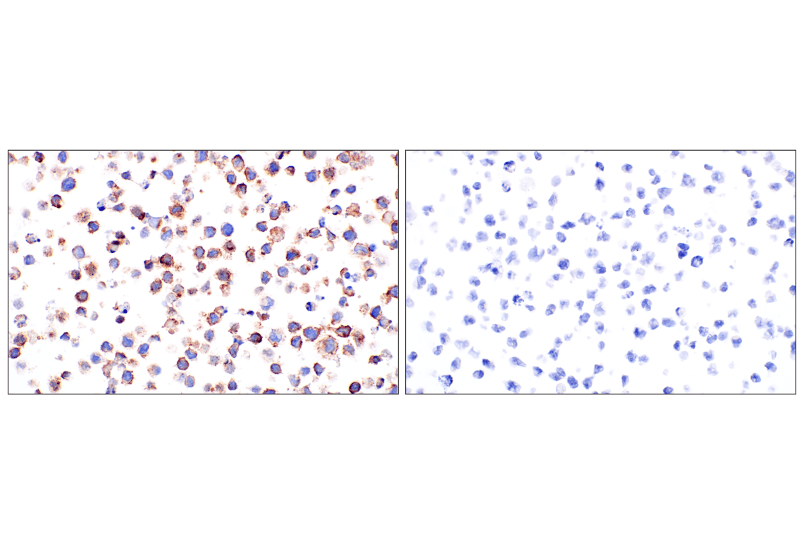 CD89/FCAR (F1T9J) Rabbit mAb | Cell Signaling Technology